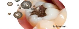 170 ročná história plombovania zubov škodlivým amalgámom