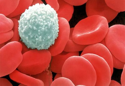 biele krvinky a leukemia