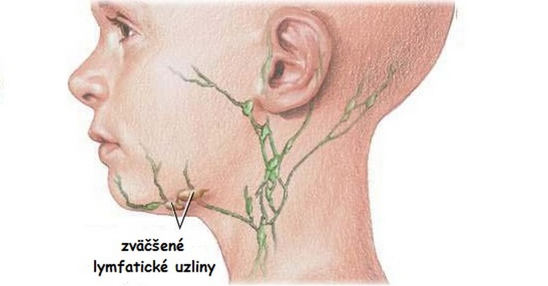 lymfatické uzliny