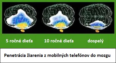 Zapal hrdla priznaky