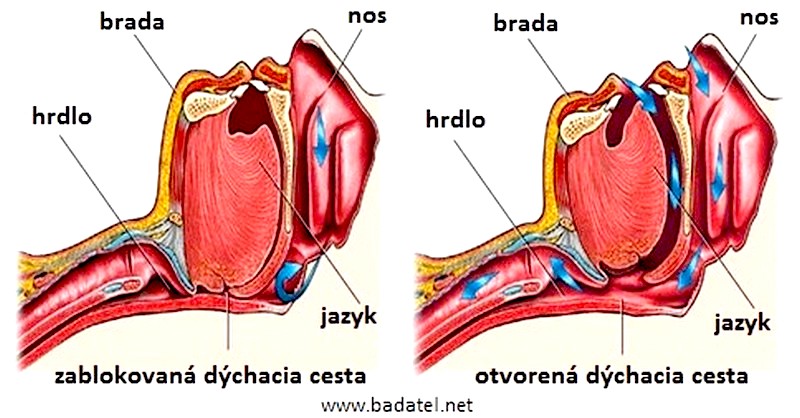 Ako proti chrápaniu: 10 vecí, čo pomáha prestať v noci chrápať