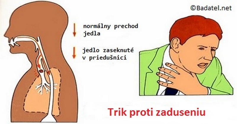 prvá pomoc pri dusení