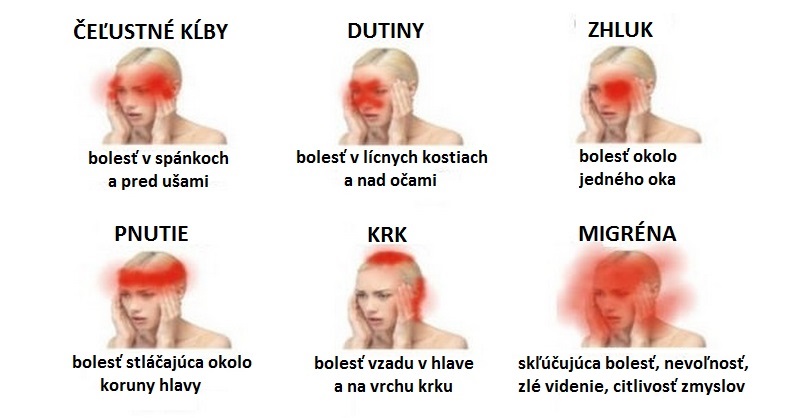 ako rozoznať bolesti hlavy