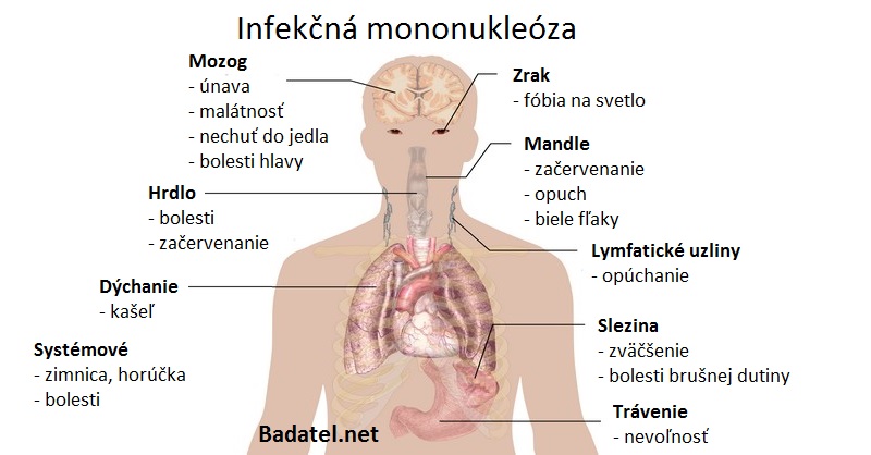 Co postihuje mononukleóza?