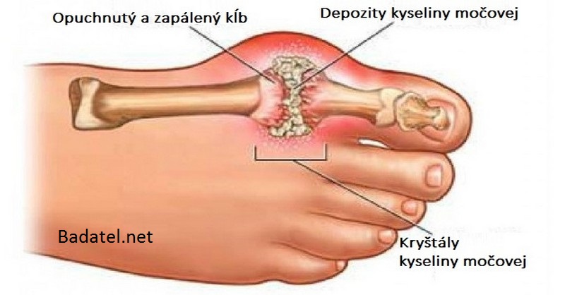 kyselina-mocova