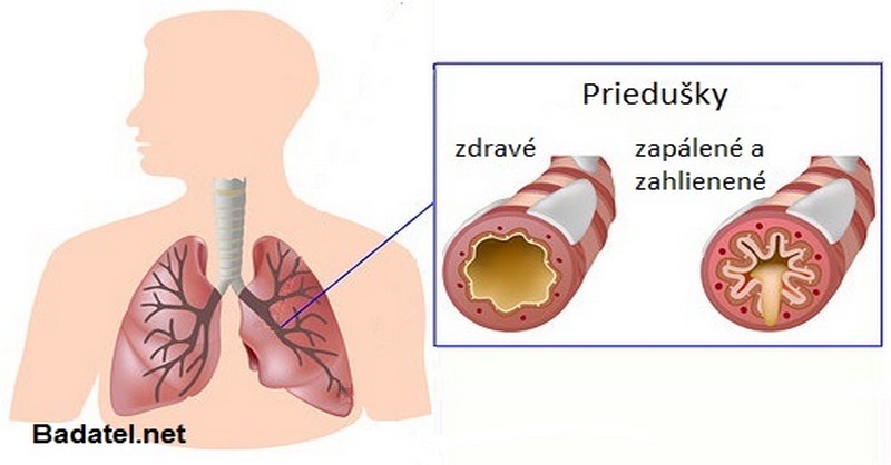 zapal-priedusiek