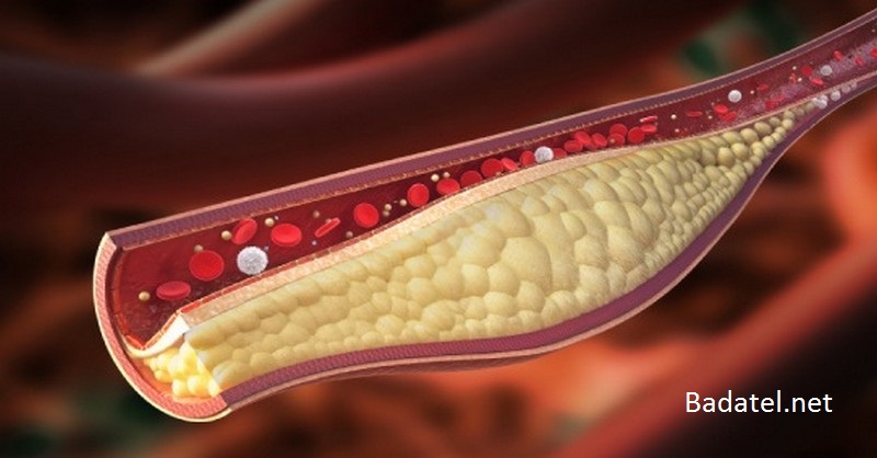 cholesterol-studia