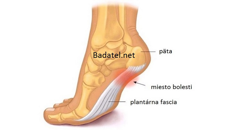 plantarna-fascia