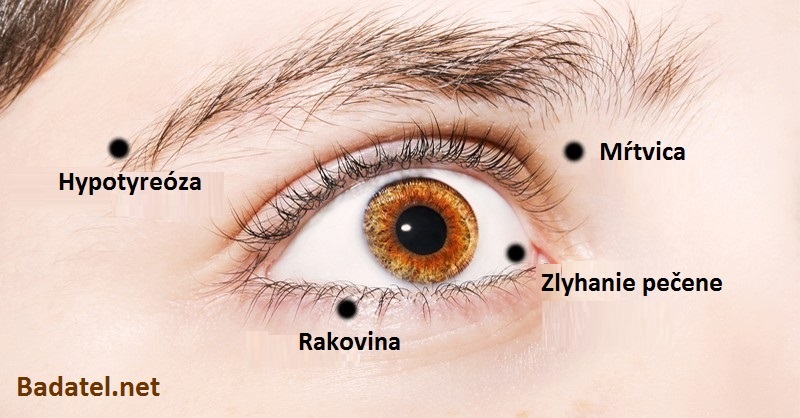 8 znakov, ktorými vám oči prezradia niečo o vašom zdraví