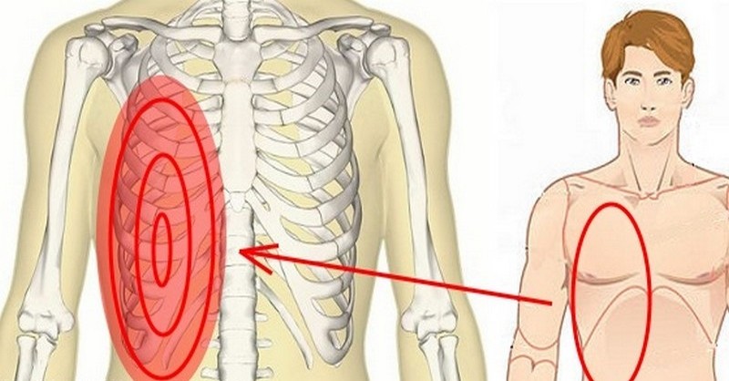 Bolesť v pravom boku pod rebrami: Príčiny a kedy navštíviť lekára