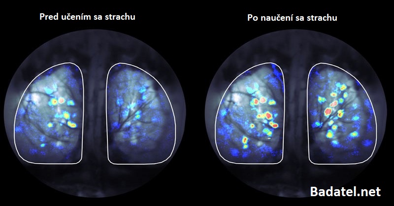 Prečo by ste mali naučiť svoj mozog, aby sa odnaučil byť chorý