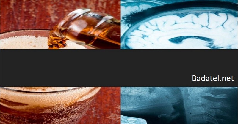 Zlá správa pre náš mozog: Tieto obľúbené sladené nápoje spôsobujú mŕtvicu a demenciu