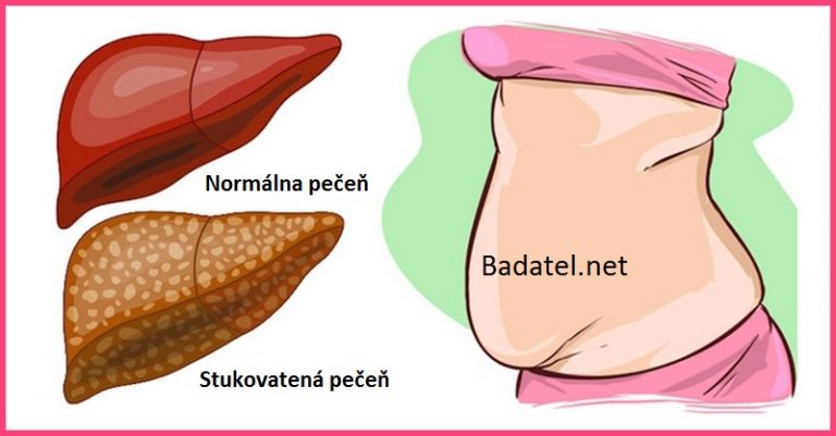 Rozlúčme sa s tukom v pečeni: Liečba pomocou týchto 6 biopotravín