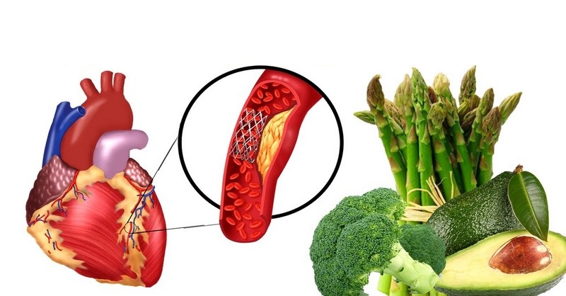 8 potravín, ktoré vám pomôžu vyčistiť artérie a znížiť krvný tlak