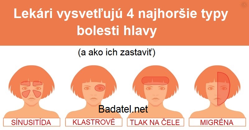 Lekári vysvetľujú 4 najhoršie typy bolesti hlavy (a ako ich zastaviť)