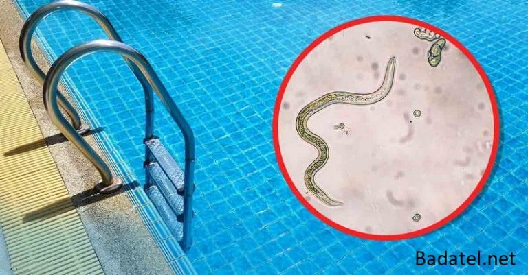 CDC varuje – parazity a baktérie môžu číhať v hotelových bazénoch i vo vírivkách