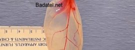 Vedci premenili špenát na tkanivo bijúceho ľudského srdca