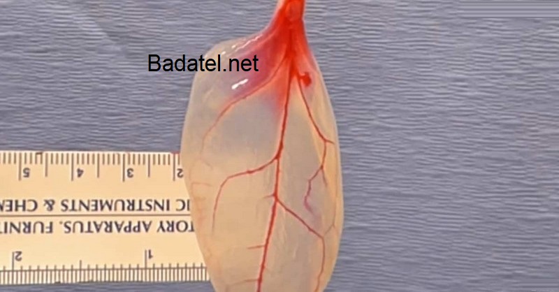 Vedci premenili špenát na tkanivo bijúceho ľudského srdca