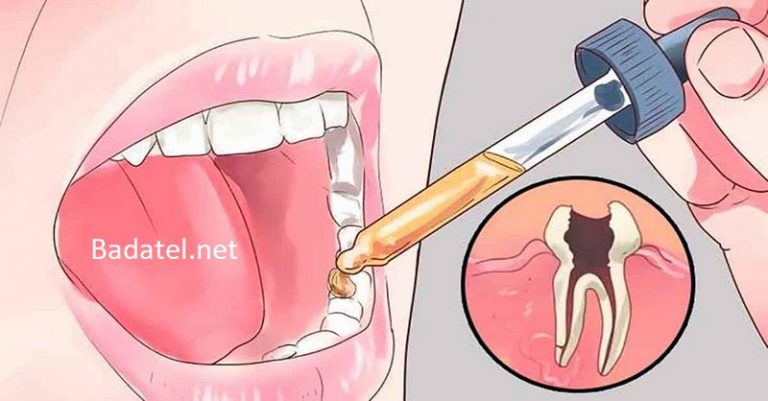 12 prírodných liečivých prostriedkov proti bolesti zubov, o ktorých váš zubár nechce, aby ste vedeli