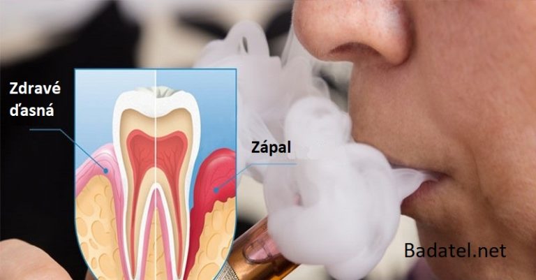 Šokujúca štúdia: Elektronická cigareta značky Vapor ničí 85 % buniek v ústach