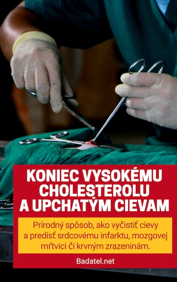 e-kniha: Koniec vysokému cholesterolu a upchatým cievam