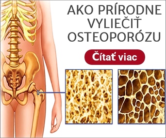 Liečba osteoporózy