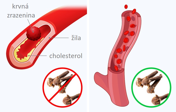 Čo sa udeje s vaším telom, keď začnete jesť denne dva klinčeky