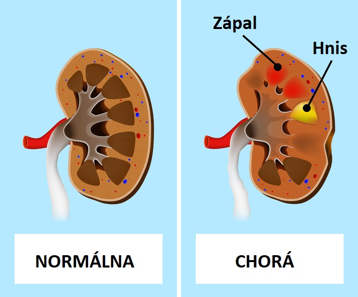 6 vecí, ktoré sa vám snažia povedať o vašom zdraví vaše opuchnuté nohy a členky