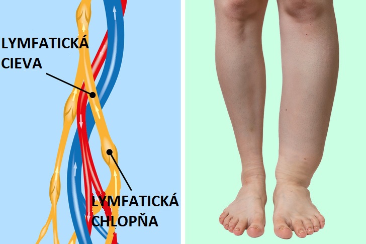 6 vecí, ktoré sa vám snažia povedať o vašom zdraví vaše opuchnuté nohy a členky