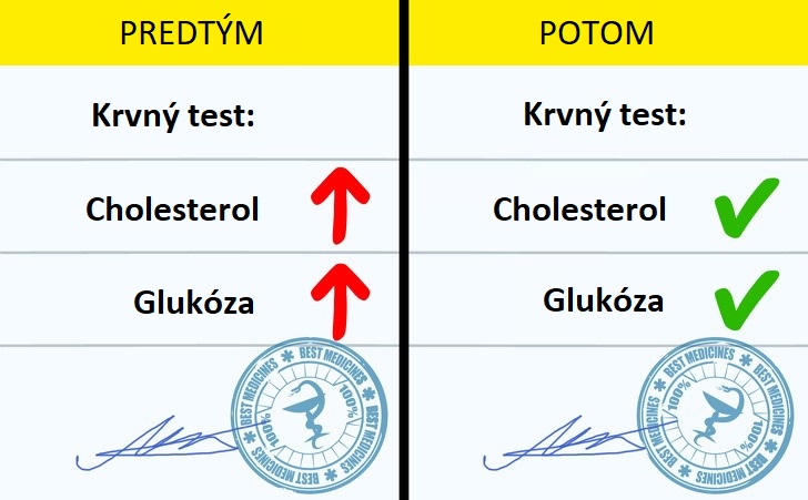 Robila som 10 minút strečingu denne po dobu 30 dní a toto sa zmenilo