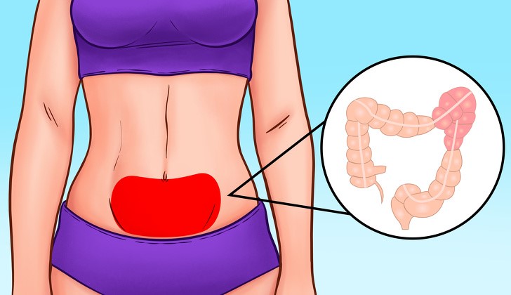 Čo prezrádza o vašom zdraví miesto, kde vás bolí brucho