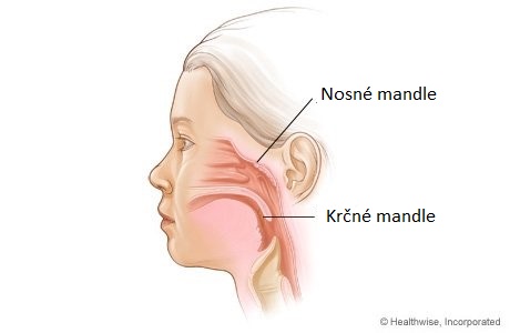 Štúdia zisťuje, že odstránenie krčných a nosných mandlí u detí zvyšuje riziko 28 chorôb
