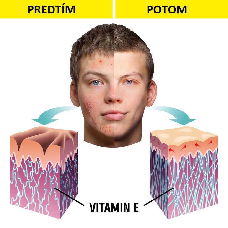 4 veci, ktoré sa stanú s vaším telom, keď začnete jesť každý deň mandle