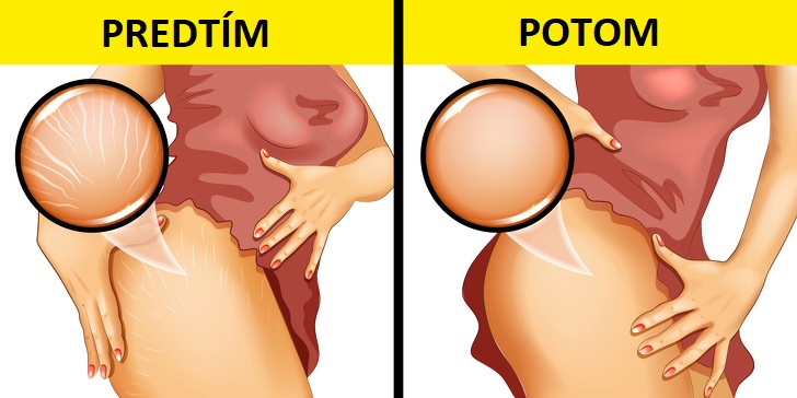 4 veci, ktoré sa stanú s vaším telom, keď začnete jesť každý deň mandle