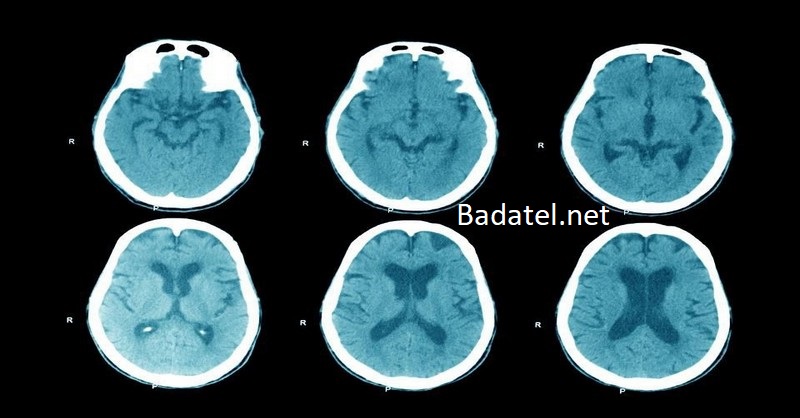 Neuroveda odhaľuje, ako môže mať 50-ročný človek mozog 25-ročného