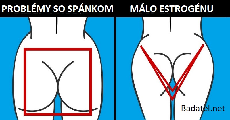 Čo prezrádza tvar vášho zadku o vašom zdraví