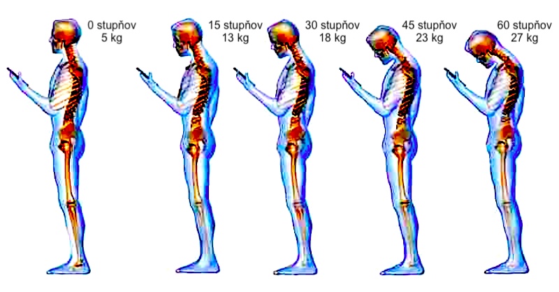 zaťaženie hlavy podľa stupňov predklonu
