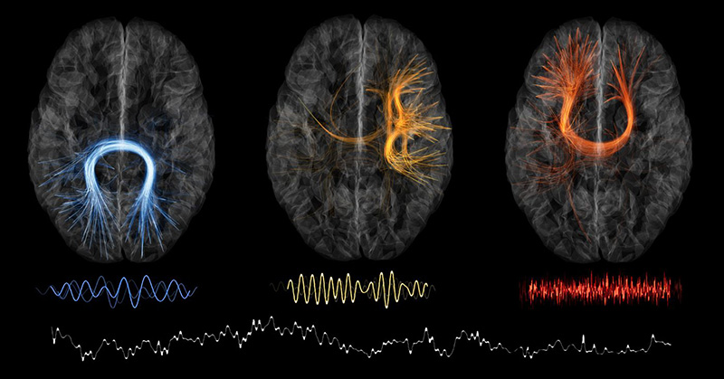 Neurovedci tvrdia, že zábudlivosť môže byť znakom vašej vysokej inteligencie