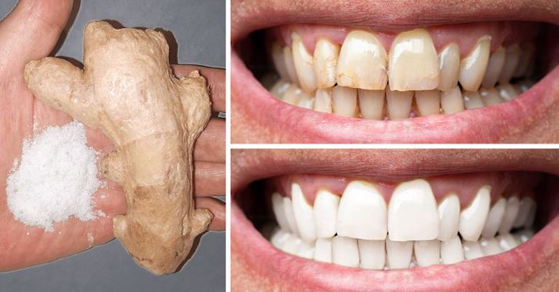 8 osvedčených prírodných spôsobov na domáce bielenie zubov