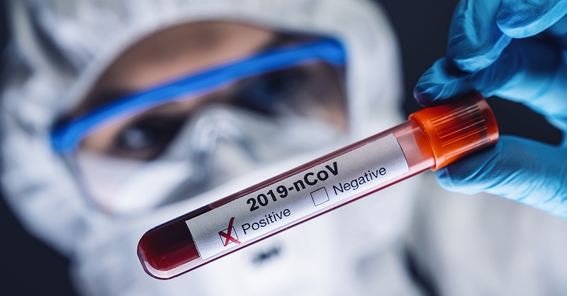 Portugalský súd rozhodol, že PCR testy sú nespoľahlivé, zrušil ľuďom karanténu