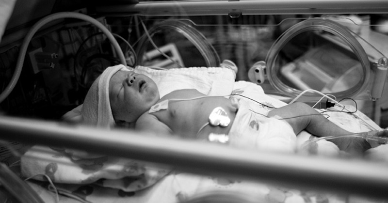 Novorodencovi museli amputovať ruku po tom, čo sa jeho matka zaočkovala proti covidu