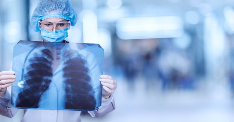 Štúdia odhalila, že pľúca väčšiny ľudí sú zanesené mikroplastami z rúšok a respirátorov