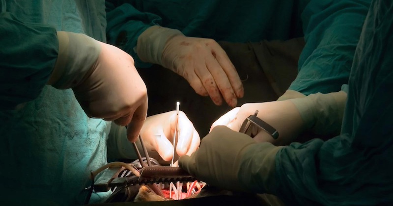 Transplantačný systém je zločinecký syndikát: Pacient sa prebudil počas operácie odberu jeho orgánov