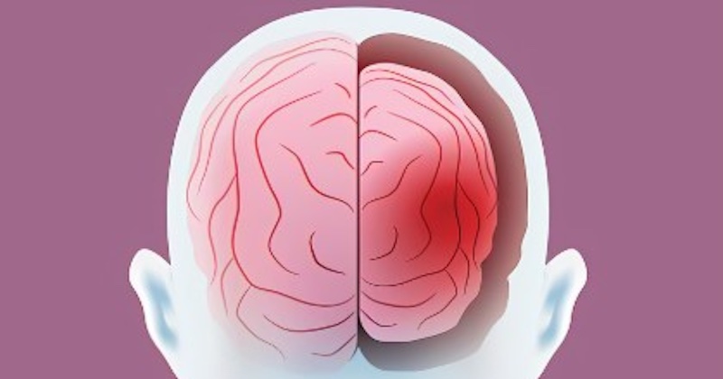 Vedci identifikovali kritické časové okno príležitosti na zastavenie zrýchleného starnutia mozgu