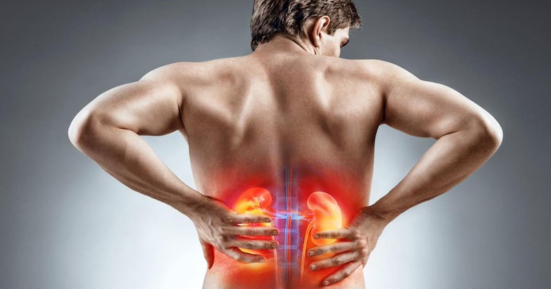 Tichá epidémia: Chronické ochorenie obličiek v súčasnosti postihuje celosvetovo až 800 miliónov ľudí Tichá epidémia: Chronické ochorenie obličiek v súčasnosti postihuje celosvetovo až 800 miliónov ľudí