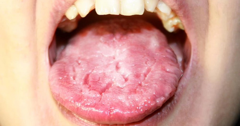 Jazyk neklame: Staroveký diagnostický nástroj vstupuje do veku umelej inteligencie