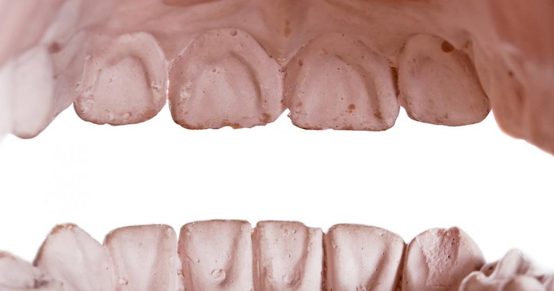 Cukor začína ničiť zuby v priebehu sekúnd, no holistické návyky dokážu škodám predchádzať