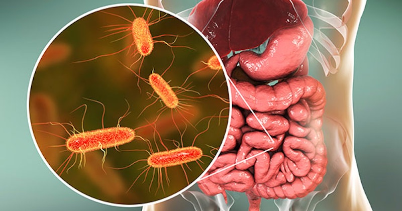 6 potravín, ktoré sabotujú váš druhý mozog: Ako obnoviť a posilniť mikrobionálnu rovnováhu v črevách 6 potravín, ktoré sabotujú váš druhý mozog: Ako obnoviť a posilniť mikrobionálnu rovnováhu v črevách