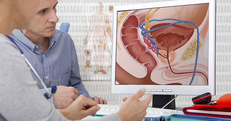 Kľúčová onkologická terapia sa ignoruje: Výskum ukazuje, že pôst využíva fatálnu zraniteľnosť rakoviny