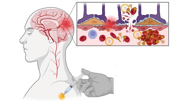 Osprostievanie a agresivita progresívcov objasnené: Štúdia potvrdila 25 až 3000-násobné riziko 86 neuropsychiatrických diagnóz u očkovaných mRNA vakcínami Osprostievanie a agresivita progresívcov objasnené: Štúdia potvrdila 25 až 3000-násobné riziko 86 neuropsychiatrických diagnóz u očkovaných mRNA vakcínami